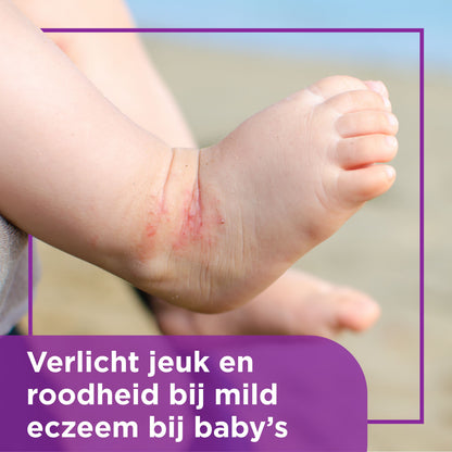 Bepanthen Eczeem baby creme 20 Gram