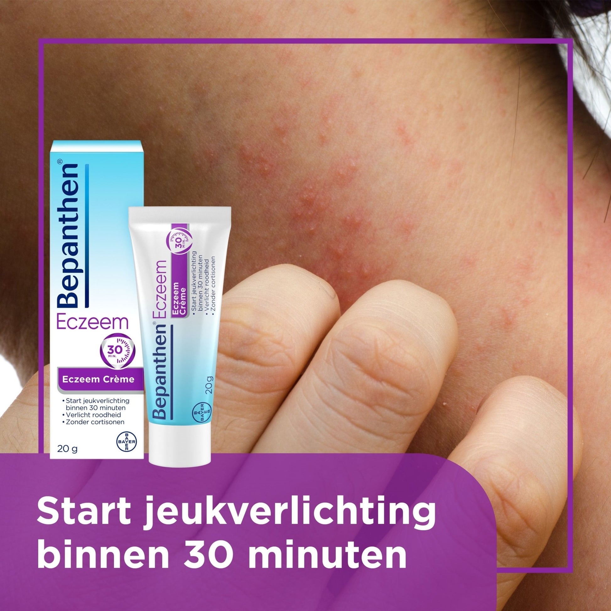Bepanthen Eczeem creme 20 Gram - DrogistWereld